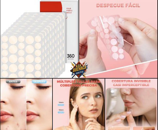 🎈 Parches Hidrocoloides Invisibles Anti-Acné 🔻–50 % Ahora por 💎4,99€ + CÓDIGO